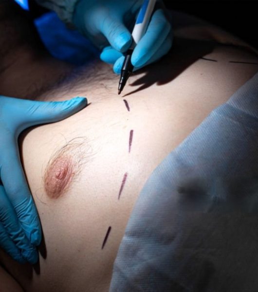 plastic surgery colombia - cirugia plastica colombia