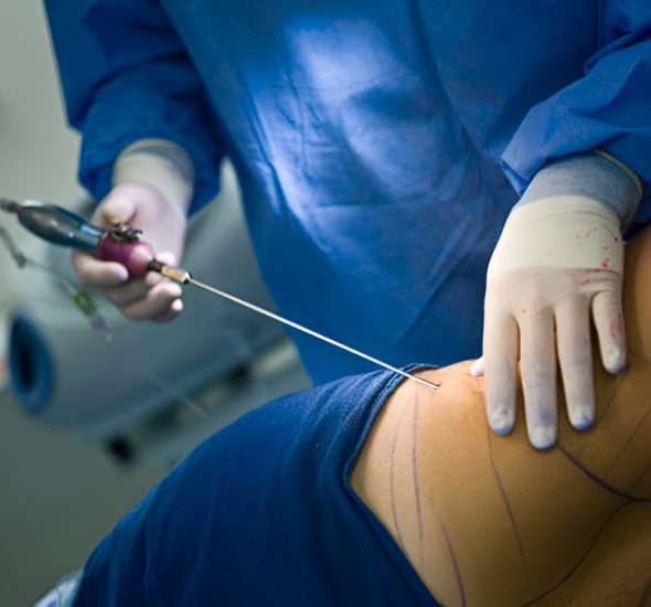 plastic surgery colombia - cirugia plastica colombia